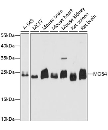 MOB4 Rabbit Polyclonal Antibody