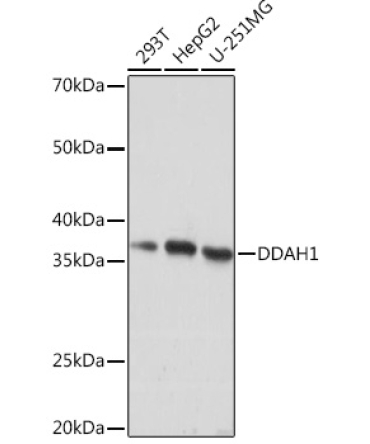 DDAH1 Rabbit Monoclonal Antibody