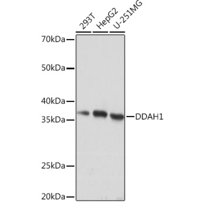 DDAH1 Rabbit Monoclonal Antibody
