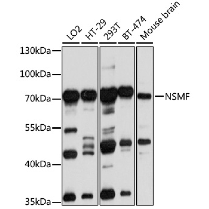 NSMF Rabbit Polyclonal Antibody