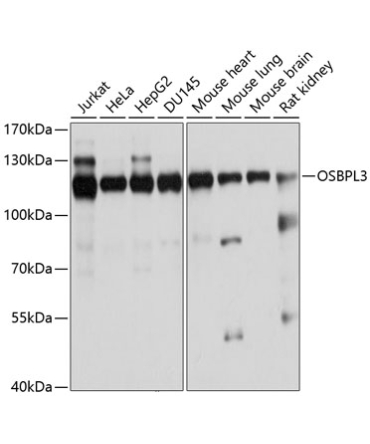 OSBPL3 Rabbit Polyclonal Antibody
