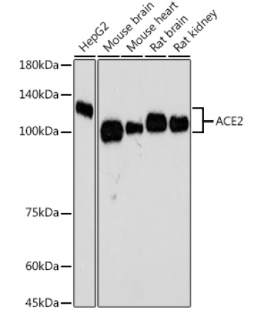 ACE2 Rabbit Monoclonal Antibody