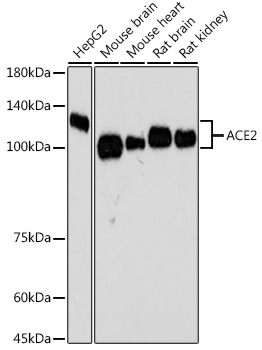 ACE2 Rabbit Monoclonal Antibody