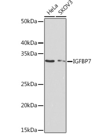 IGFBP7 Rabbit Monoclonal Antibody