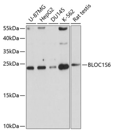 BLOC1S6 Rabbit Polyclonal Antibody