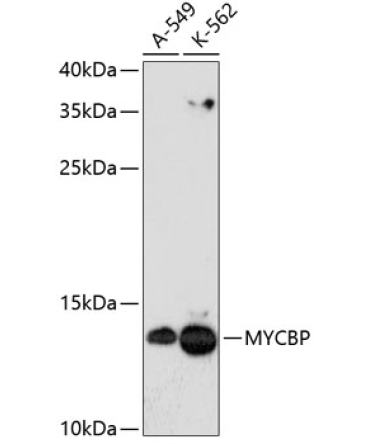 MYCBP Rabbit Polyclonal Antibody