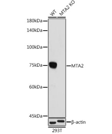 MTA2 Rabbit Monoclonal Antibody [KO Validated]