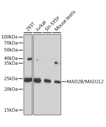 MAD2B/MAD2L2 Rabbit Monoclonal Antibody