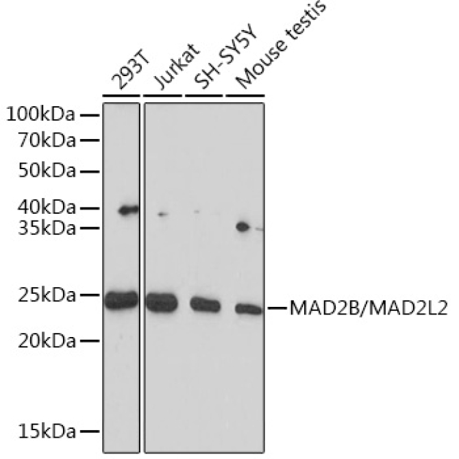 MAD2B/MAD2L2 Rabbit Monoclonal Antibody