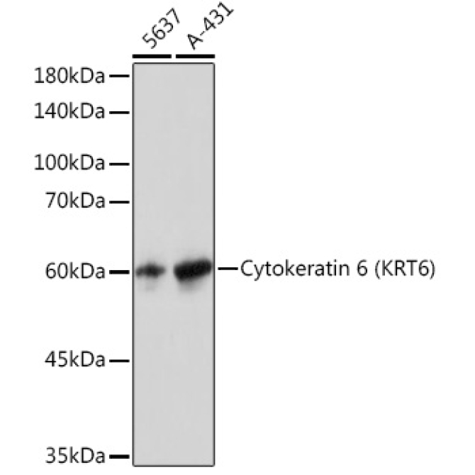 Cytokeratin 6 (KRT6) Rabbit Monoclonal Antibody
