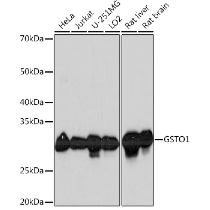 GSTO1 Rabbit Monoclonal Antibody
