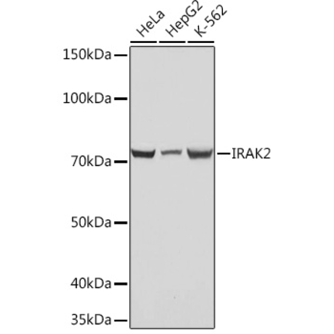 IRAK2 Rabbit Monoclonal Antibody