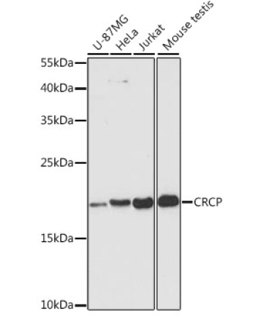 CRCP Rabbit Polyclonal Antibody