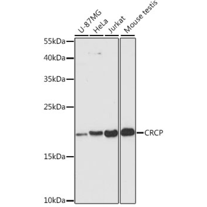 CRCP Rabbit Polyclonal Antibody
