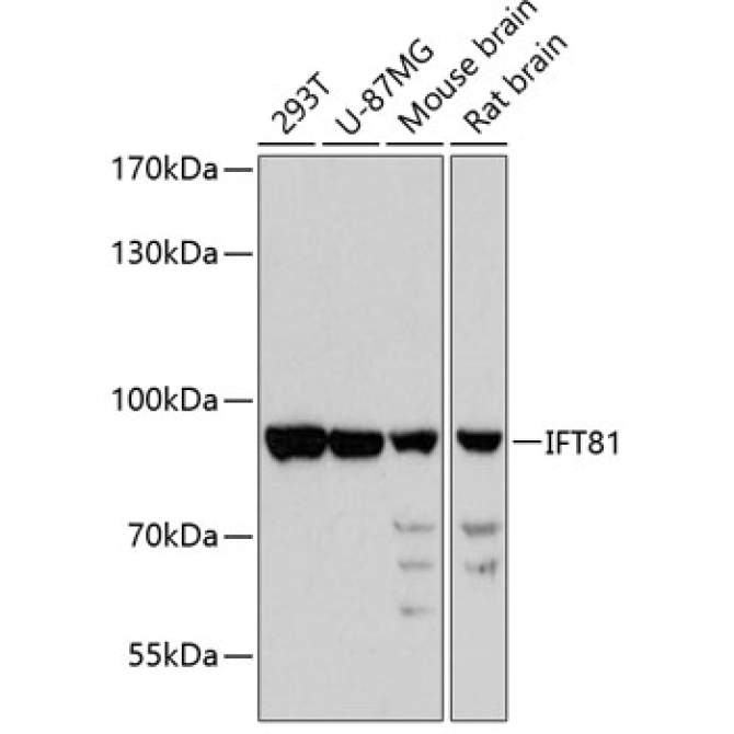 IFT81 Rabbit Polyclonal Antibody