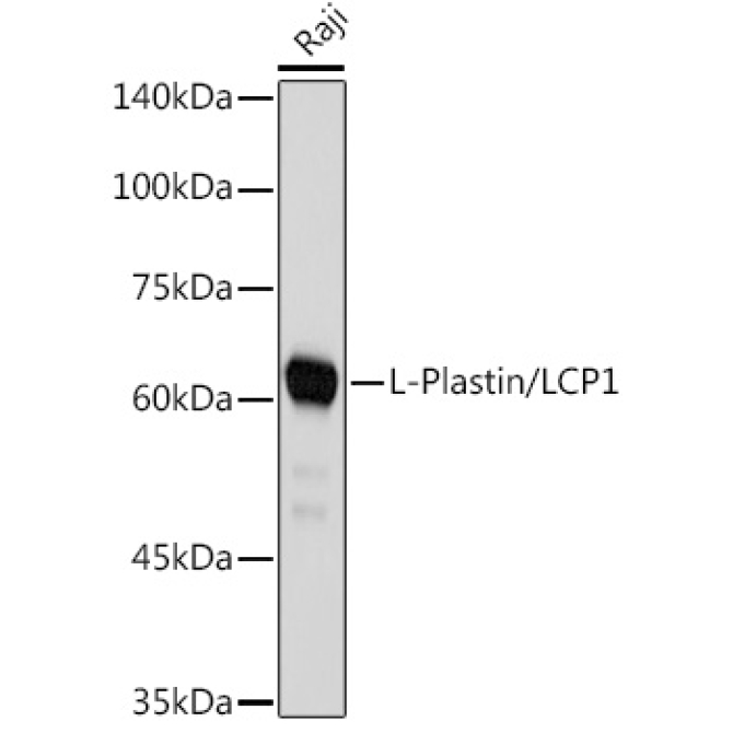 L-Plastin/LCP1 Rabbit Monoclonal Antibody