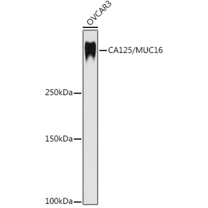 CA125 / MUC16 Rabbit Monoclonal Antibody