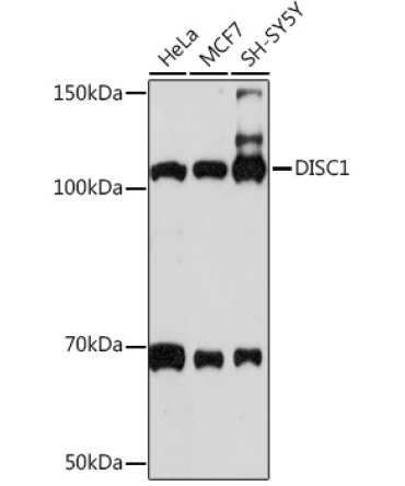 DISC1 Rabbit Monoclonal Antibody