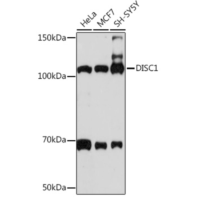 DISC1 Rabbit Monoclonal Antibody