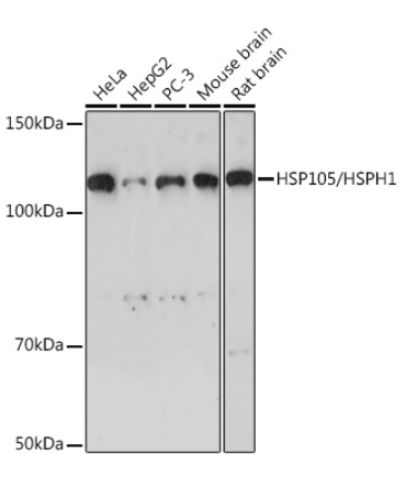HSP105/HSPH1 Rabbit Monoclonal Antibody