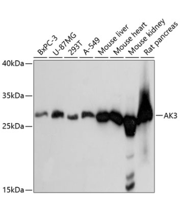 AK3 Rabbit Polyclonal Antibody
