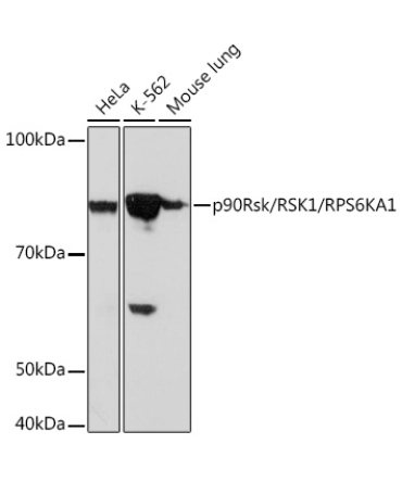 p90Rsk/RSK1/RPS6KA1 Rabbit Monoclonal Antibody