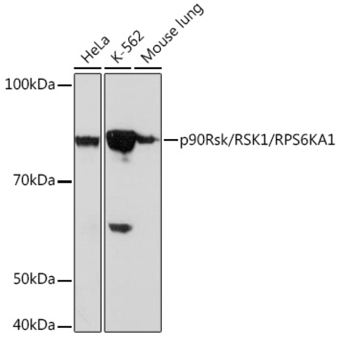 p90Rsk/RSK1/RPS6KA1 Rabbit Monoclonal Antibody