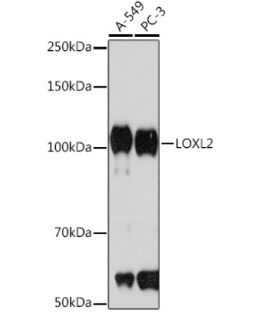LOXL2 Rabbit Monoclonal Antibody