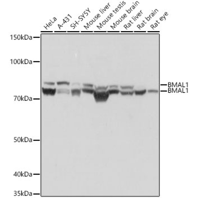 BMAL1 Rabbit Monoclonal Antibody