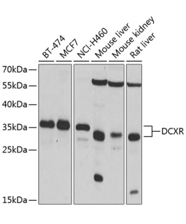 DCXR Rabbit Polyclonal Antibody