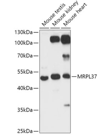 MRPL37 Rabbit Polyclonal Antibody