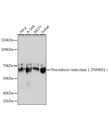 Human Thioredoxin Reductase 1/TRXR1 Rabbit Monoclonal Antibody