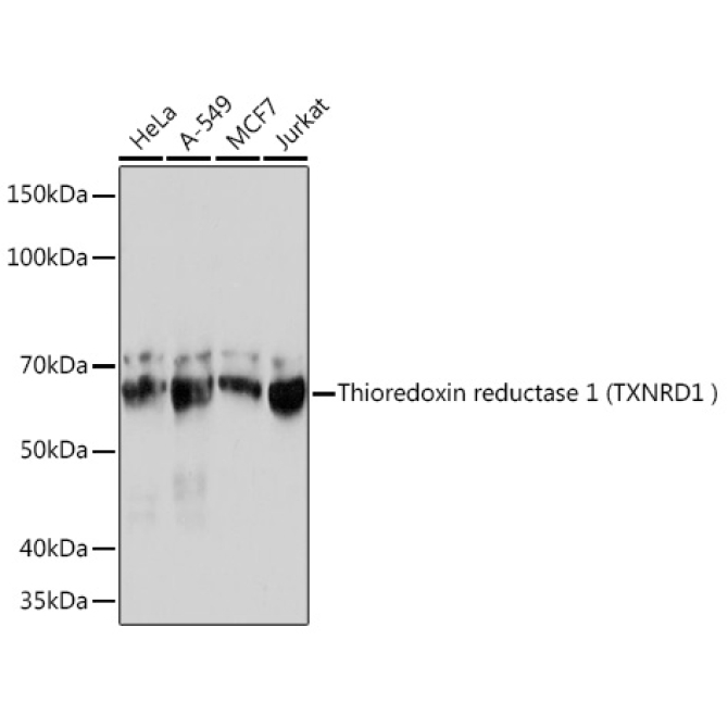 Human Thioredoxin Reductase 1/TRXR1 Rabbit Monoclonal Antibody