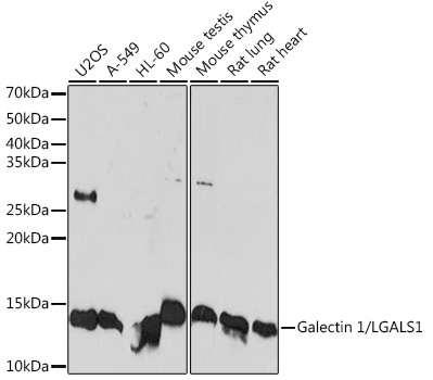 Galectin 1/LGALS1 Rabbit Monoclonal Antibody