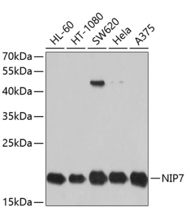 NIP7 Rabbit Polyclonal Antibody