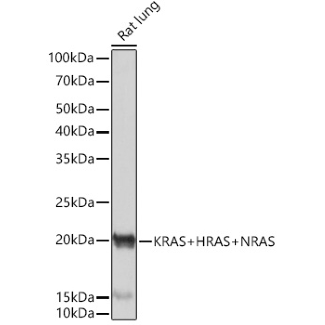 KRAS+HRAS+NRAS Rabbit Monoclonal Antibody