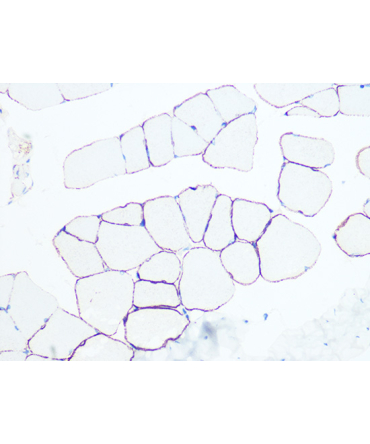Dystrophin Rabbit Monoclonal Antibody