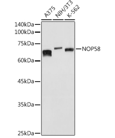 NOP58 Rabbit Polyclonal Antibody