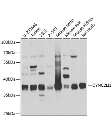 DYNC2LI1 Rabbit Polyclonal Antibody