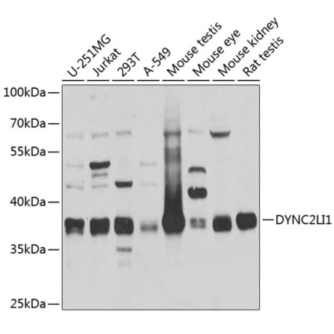 DYNC2LI1 Rabbit Polyclonal Antibody