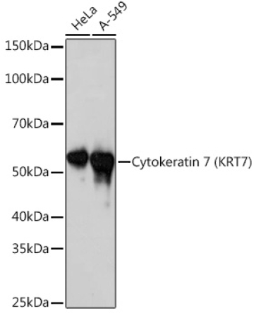 Cytokeratin 7 (KRT7) Rabbit Monoclonal Antibody