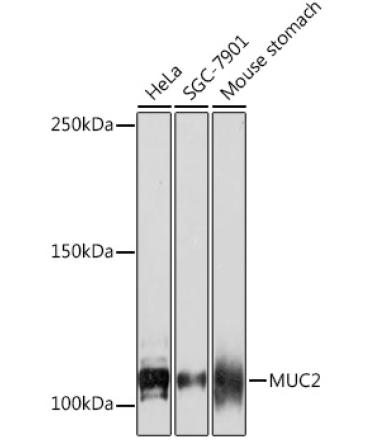 MUC2 Rabbit Monoclonal Antibody