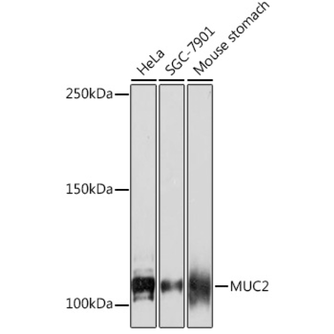 MUC2 Rabbit Monoclonal Antibody