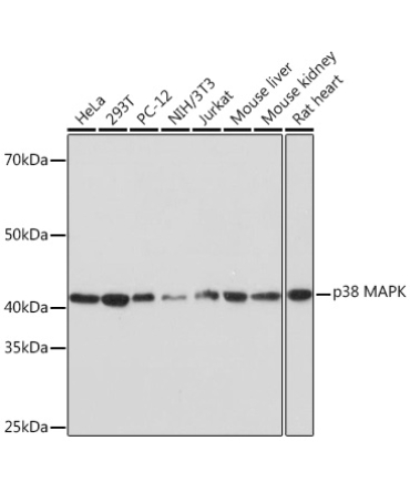 p38 MAPK Rabbit Monoclonal Antibody [KO Validated]