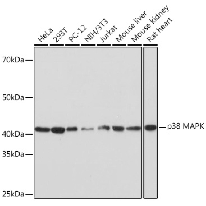 p38 MAPK Rabbit Monoclonal Antibody [KO Validated]