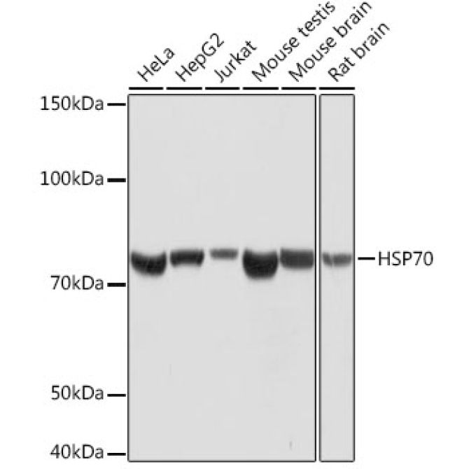 HSP70 Rabbit Monoclonal Antibody
