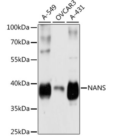 NANS Rabbit Polyclonal Antibody