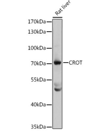 CROT Rabbit Polyclonal Antibody