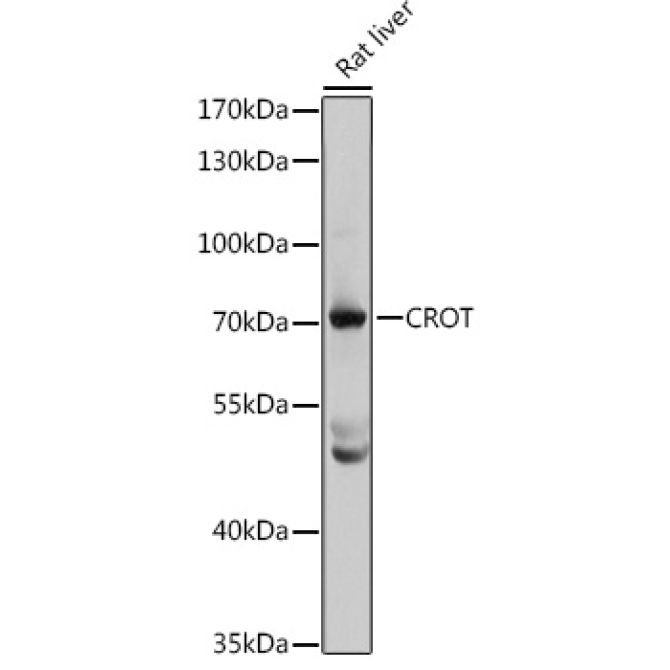 CROT Rabbit Polyclonal Antibody