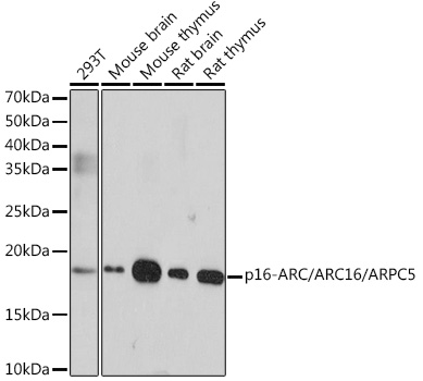p16-ARC/ARC16/ARPC5 Rabbit Monoclonal Antibody